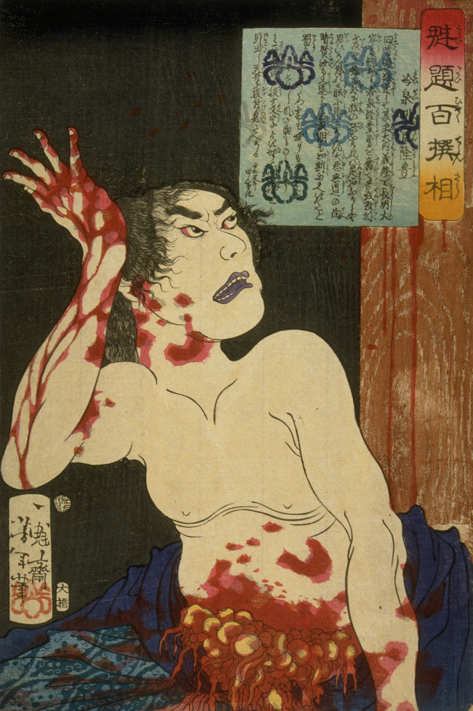 Reisei Hangan Takatoyo dying of disembowelment