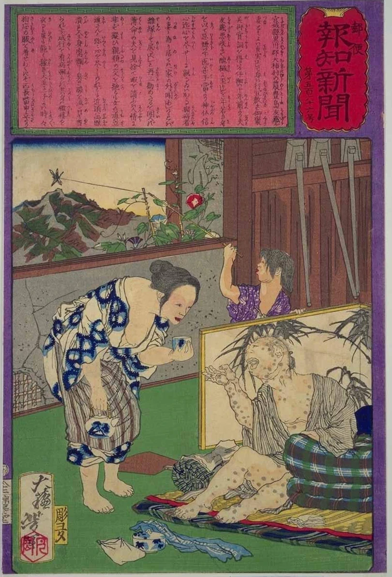 #566. Toshima Tomiyo, the loyal wife who did not leave her husband Tomozo, a farmer, even when he contracted leprosy.